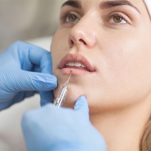 Dermal Fillers-1